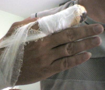 ShortFinger.JPG